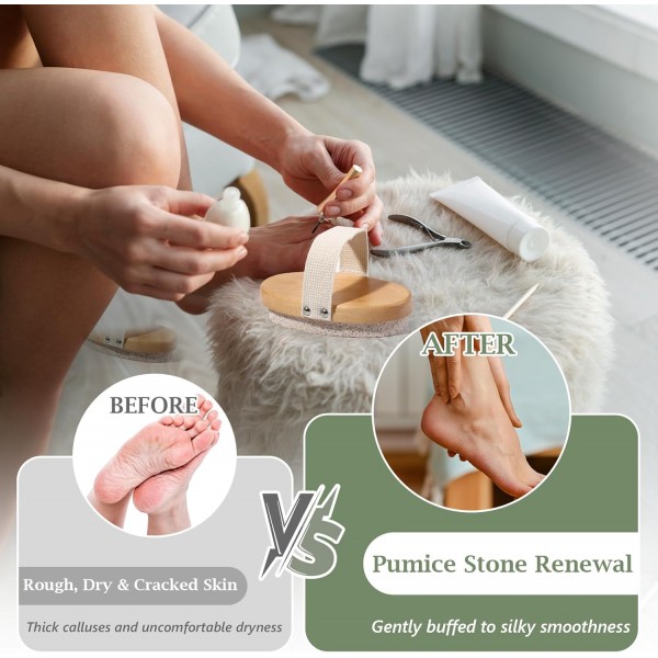 1 Pcs Pumice Stone for Feet with Handle Foot Scrubber Dead Skin Callus Remover Heel Scraper Pedicure Tool for Feet Hands Shower Remove Calluses Dry Skin