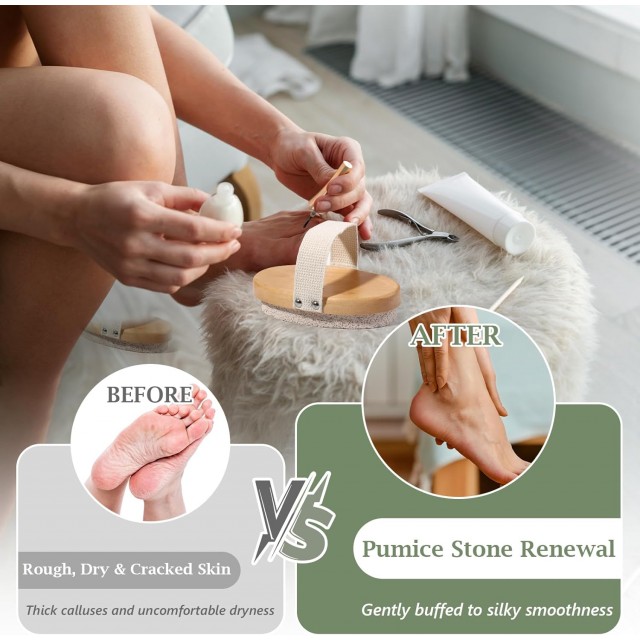 1 Pcs Pumice Stone for Feet with Handle Foot Scrubber Dead Skin Callus Remover Heel Scraper Pedicure Tool for Feet Hands Shower Remove Calluses Dry Skin
