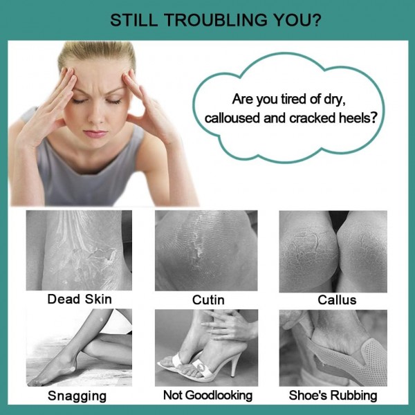 Foot File Callus Remover - Multi Purpose 4 in 1 Feet Pedicure Tools with Foot Scrubber, Pumice Stone, Foot Rasp and Sand Paper for Home Foot Care