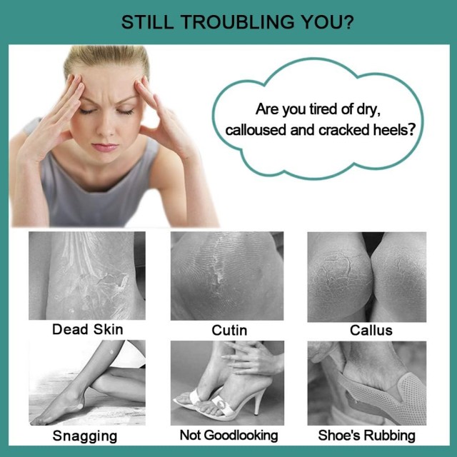 Foot File Callus Remover - Multi Purpose 4 in 1 Feet Pedicure Tools with Foot Scrubber, Pumice Stone, Foot Rasp and Sand Paper for Home Foot Care